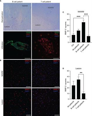 Identification of a novel role for matrix metalloproteinase-3 in the modulation of B cell responses in multiple sclerosis